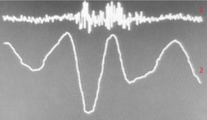 Figure 5. 1 - uninformative signal; 2 – the AAW movement pattern while saying the words “Excuse me”
