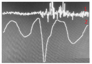 Figure 6. 1 - uninformative signal; 2 – the AAW movement pattern while saying the words “Excuse me please, where is the subway station?”