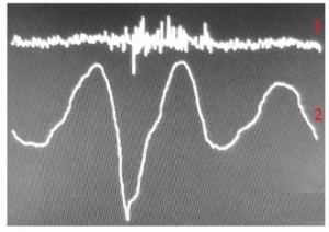 Figure 7. 1 - uninformative signal; 2 – the AAW movement pattern while saying the words “I live and work in Moscow”.